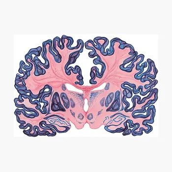Gyri Ir Swirls Žmogaus Smegenų Plakatas Sitcker už Kambarį, Bamperis Kambarį Bagažo Mielas Lipdukai Anime Spausdinti Vaikas Langų Dekoro